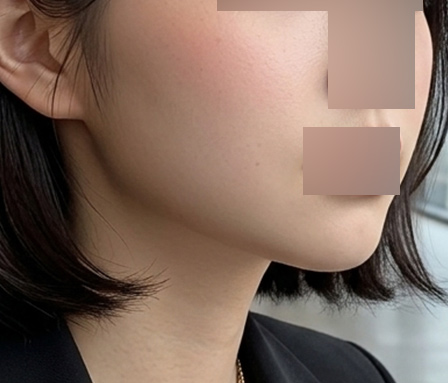 수술후 썸네일