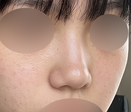 수술전 썸네일