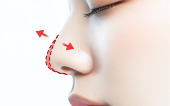 #3 코높이와 라인 불만족